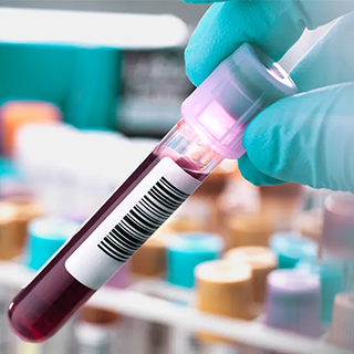 ОНКОМАРКЕРЫ – СДАВАТЬ ИЛИ НЕТ?