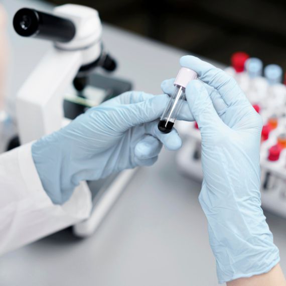 ЖИДКОСТНАЯ БИОПСИЯ ПРИ ОНКОЛОГИИ